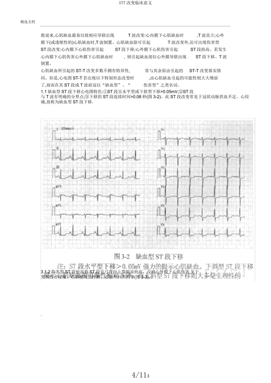 STT改变临床意义.docx_第4页