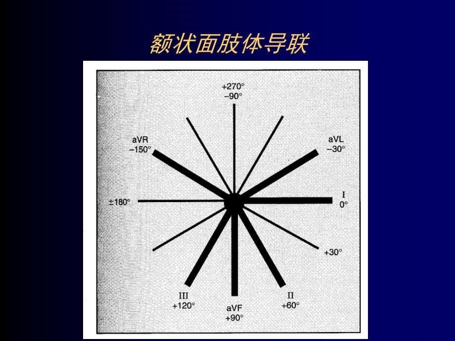 围术期心律失常的诊断与治疗ppt课件_第5页