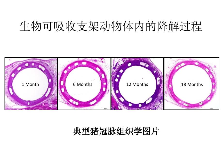 最新心血管介入治疗技术.ppt_第4页