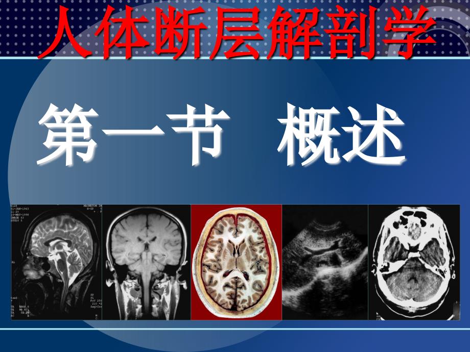 人体断层解剖学胸部断层解剖PPT课件_第3页