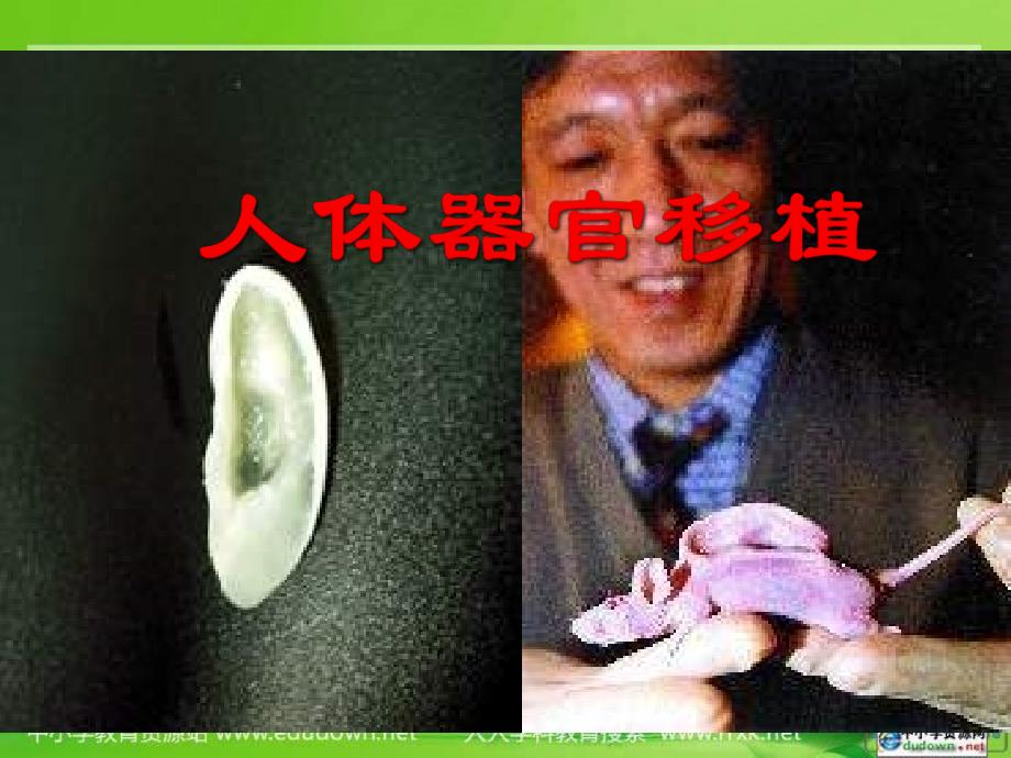 苏教版生物选修2第三节人体器管移植课件_第1页