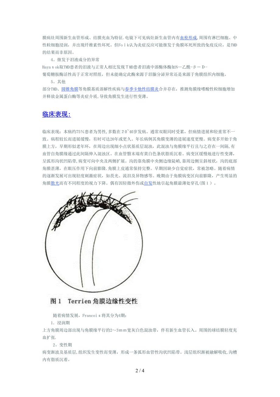 Terrien角膜边缘性变性_第2页