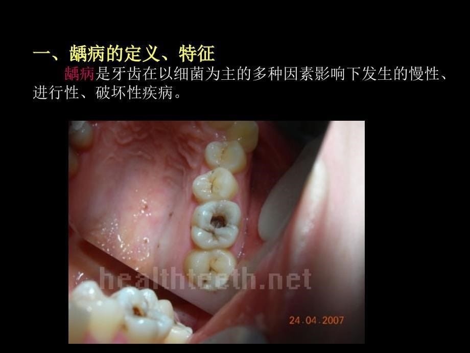 口腔学：牙体牙髓疾病_第5页