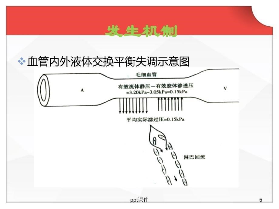 肾性水肿--ppt课件_第5页