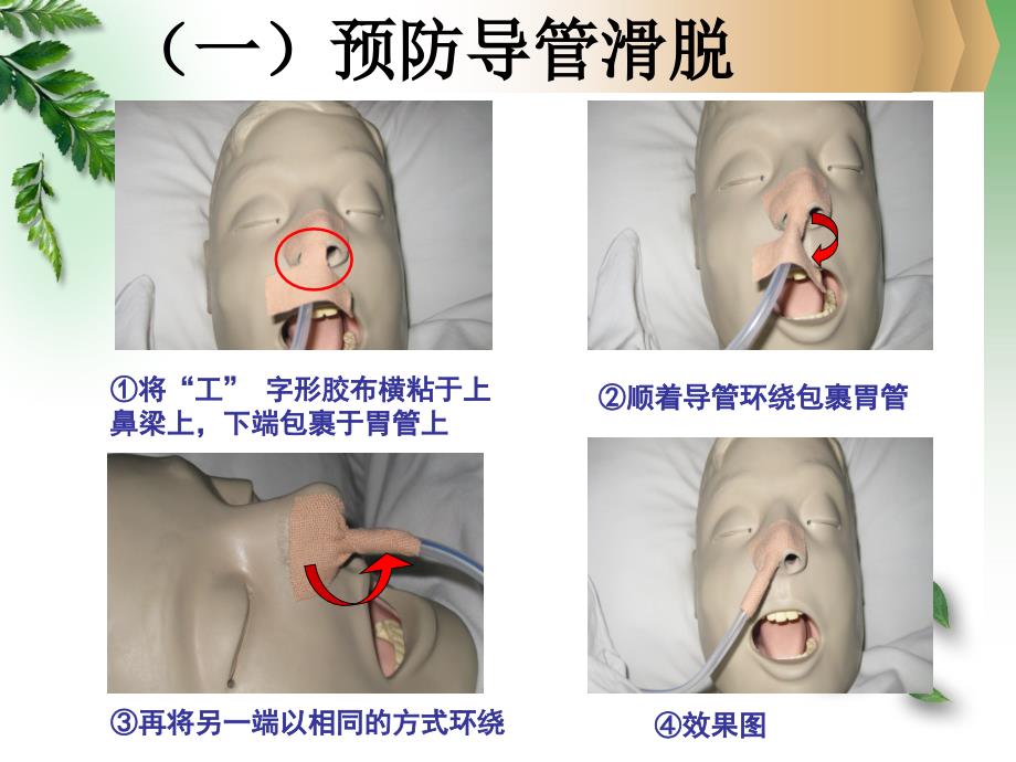 各类导管的护理111ppt课件_第4页