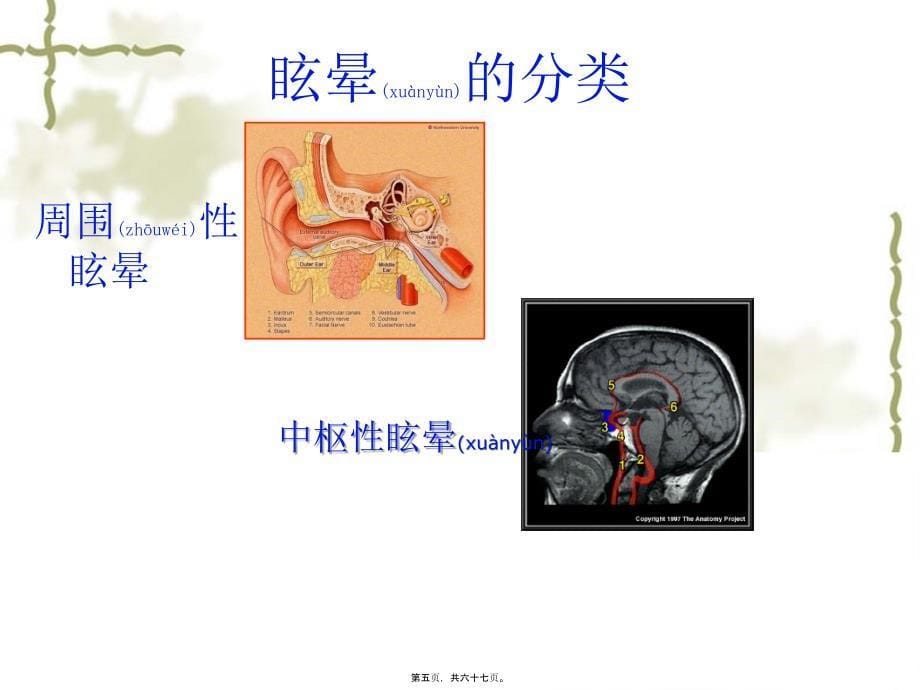 医学专题—眩晕之耳石症2013.1230908_第5页