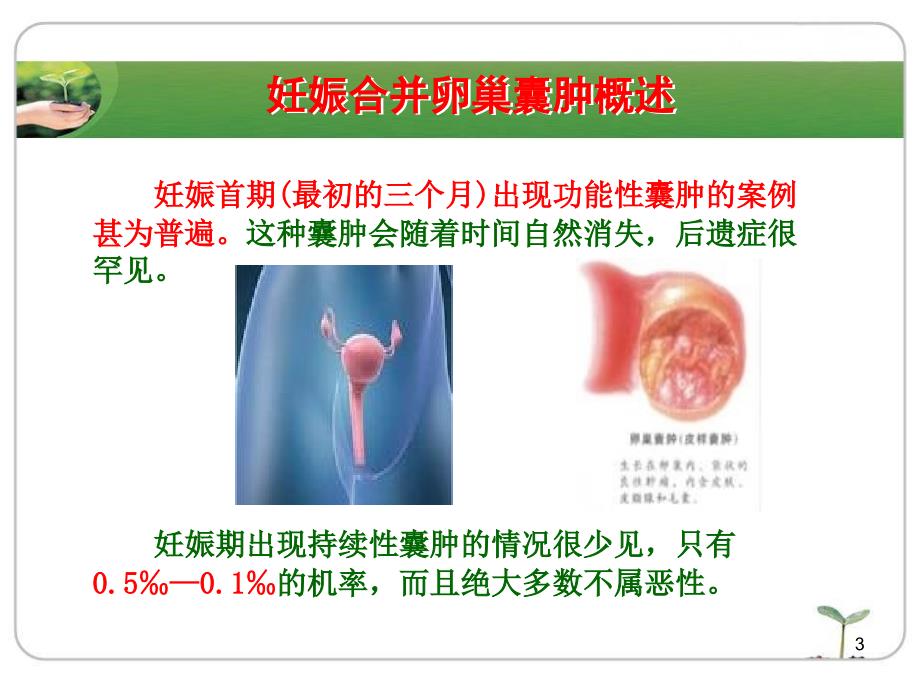 妊娠合并卵巢囊肿课件_第3页