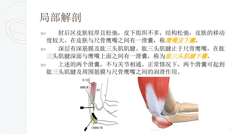 尺骨鹰嘴滑膜囊炎ppt课件_第4页