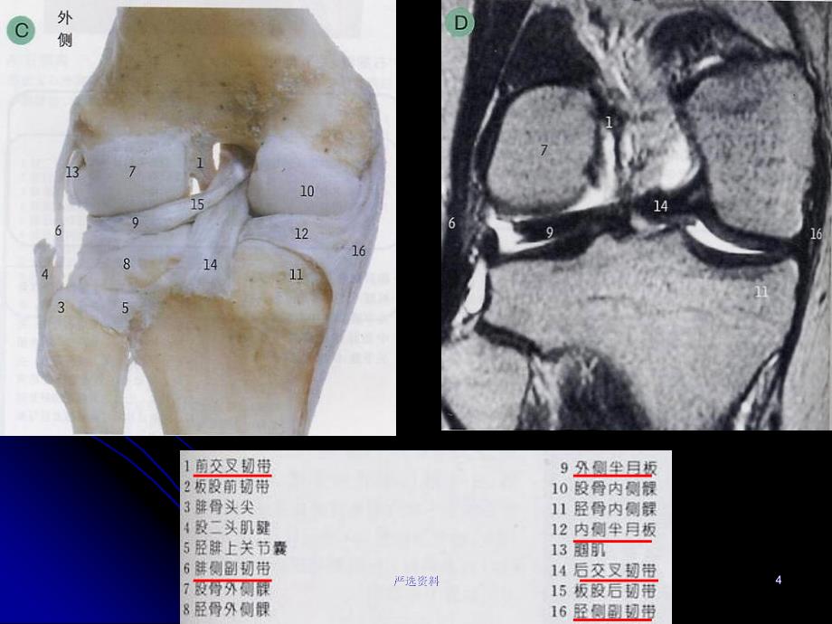 膝关节解剖及MRI诊断（行业荟萃）_第4页