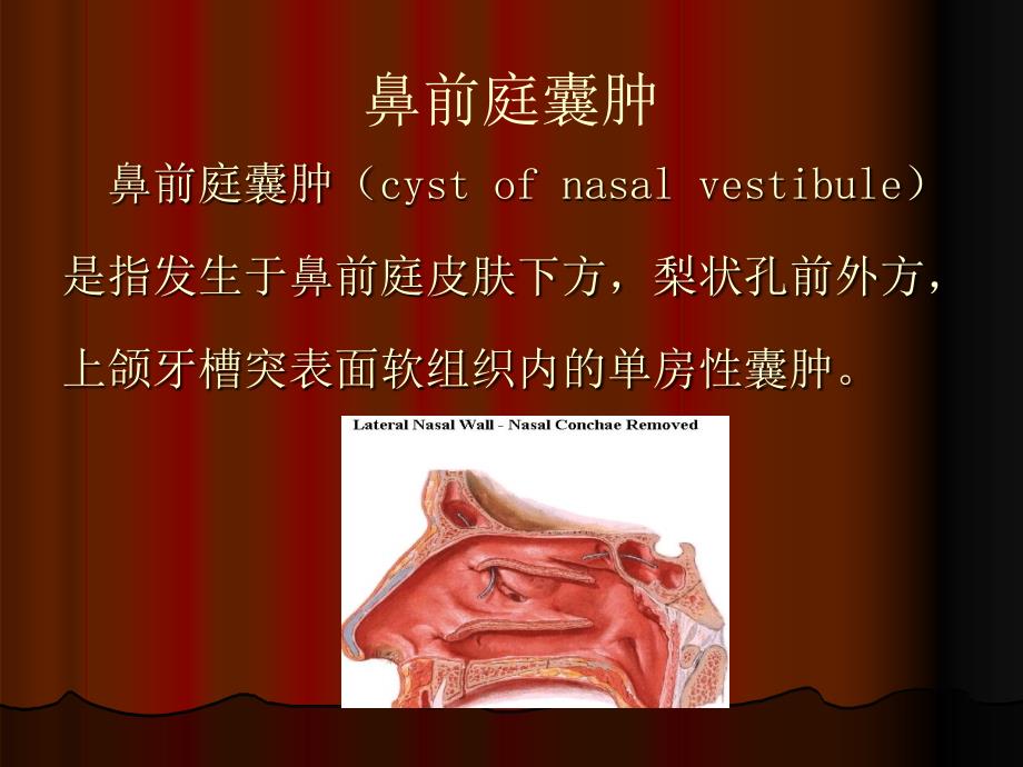 鼻鼻窦囊肿课件_第3页