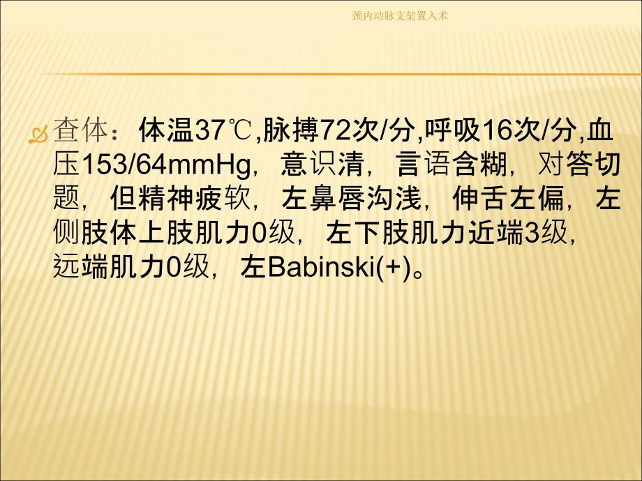 颈内动脉支架置入术课件_第3页