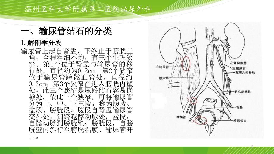 输尿管结石的微创治疗ppt课件_第2页