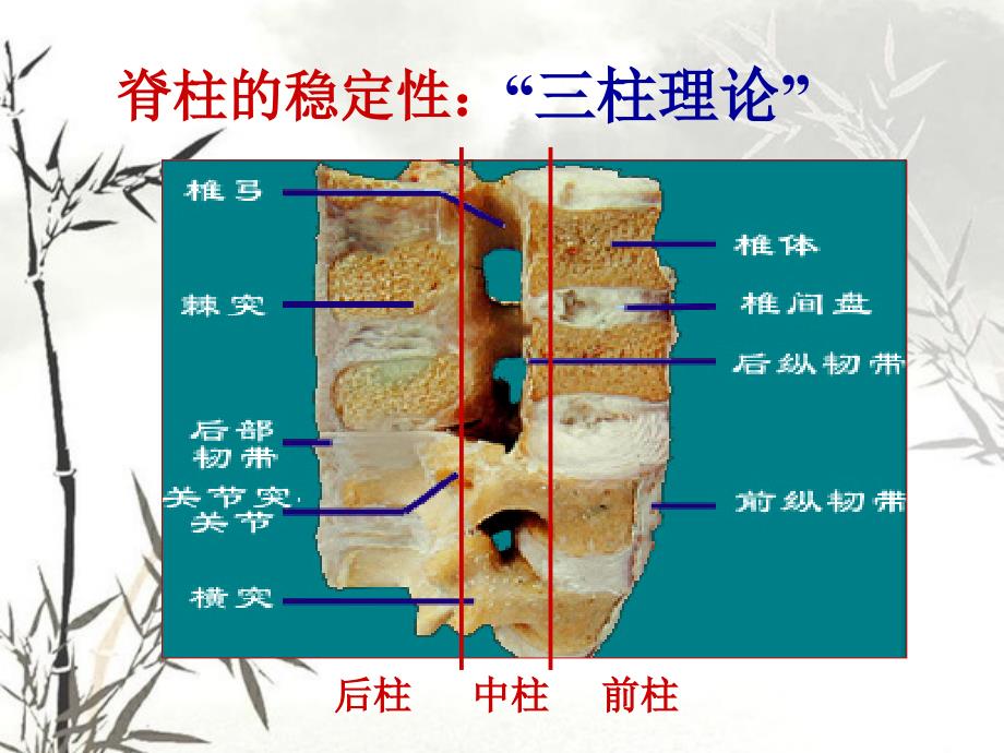 脊柱骨折和骨盆骨折_第4页