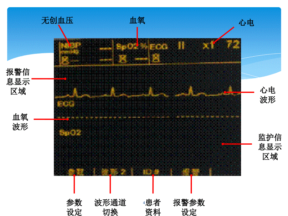 除颤仪使用_第4页