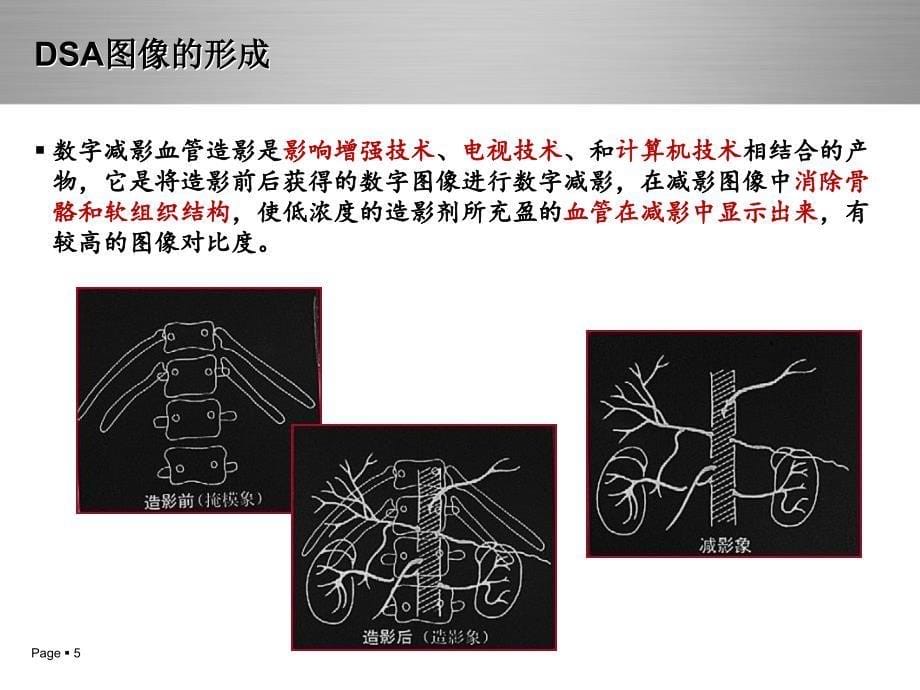 神经介入治疗DSA概述及护理常规_第5页