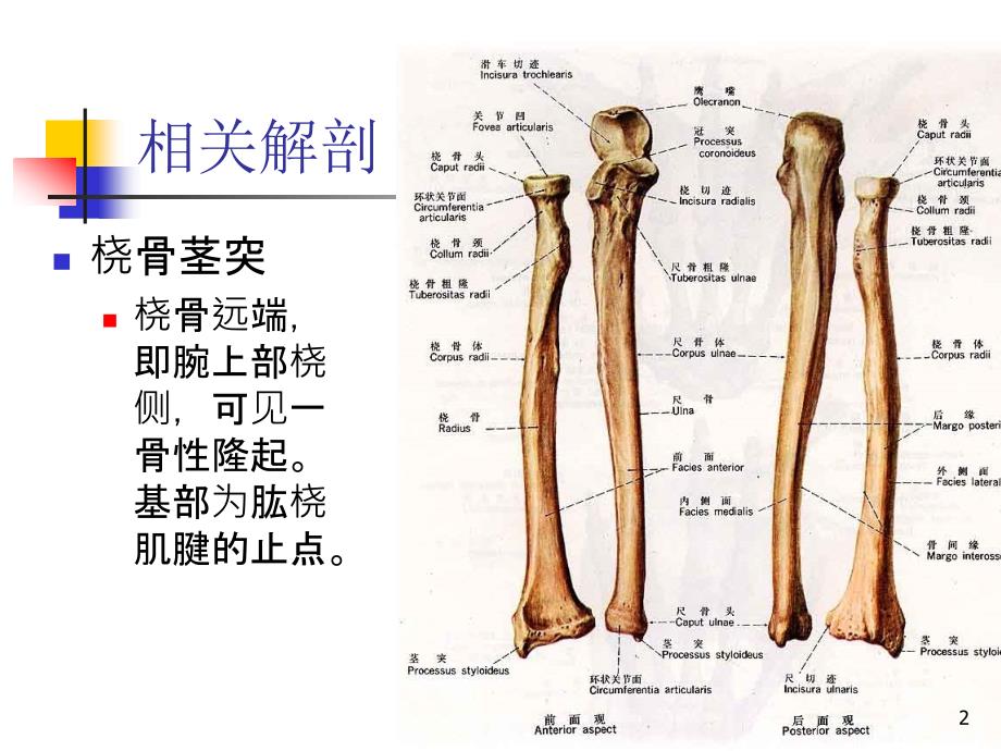 桡骨茎突部狭窄性腱鞘炎ppt课件_第2页