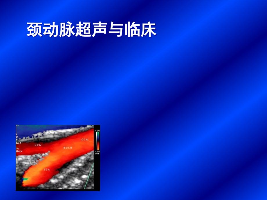 颈动脉超声表现_第1页