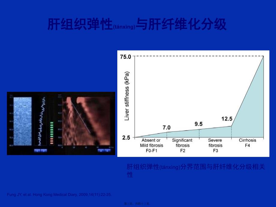 医学专题—乙肝肝硬化并发症的处理34074_第3页