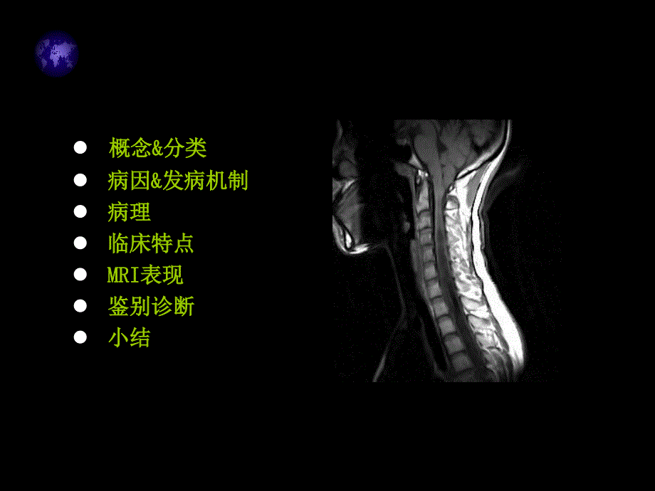 脊髓空洞症MRI表现_第2页