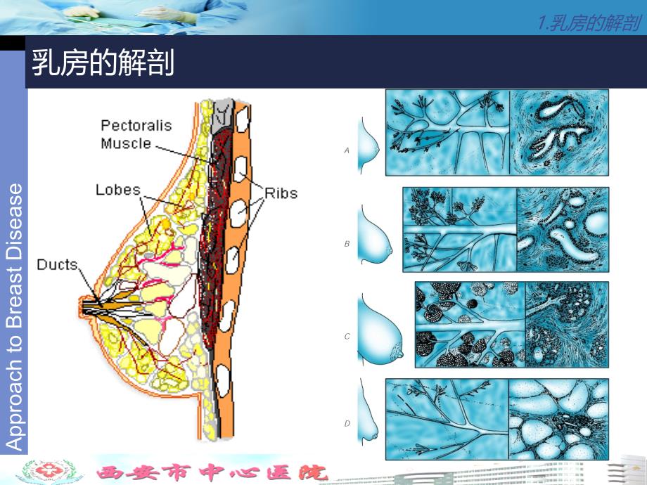 乳腺癌及乳腺癌手术配合课件_第4页