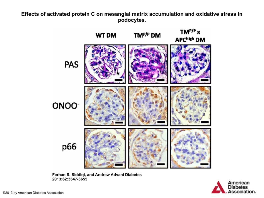 EffectsofactivatedproteinConmesangialmatrix_第1页