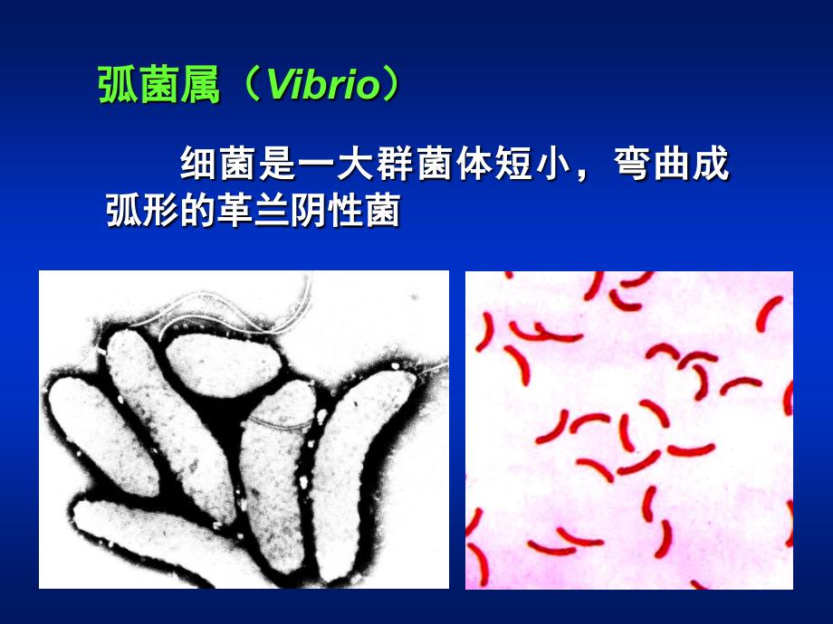 医学课件第11章弧菌属_第2页