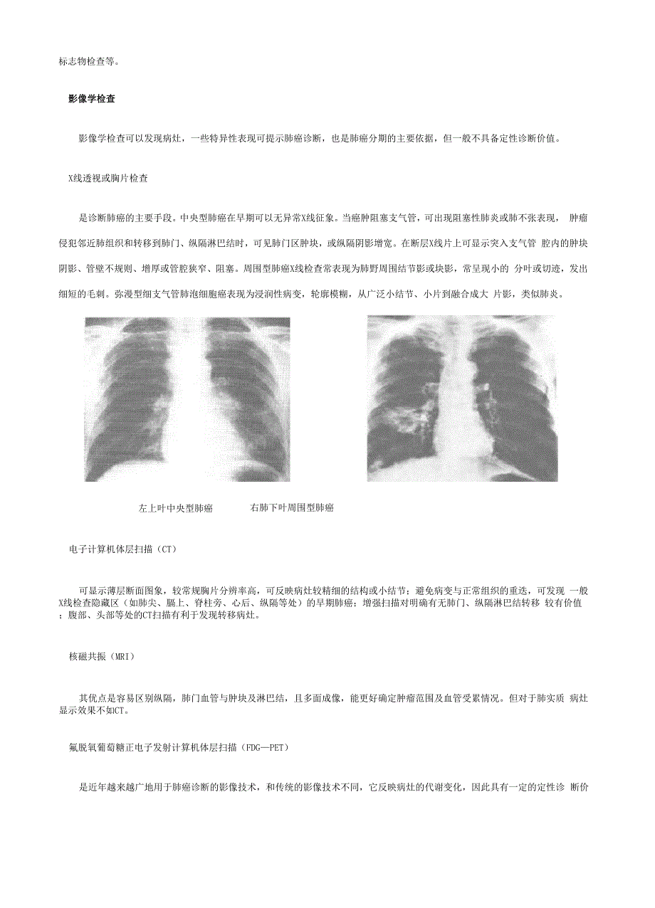 肺癌的诊断_第3页