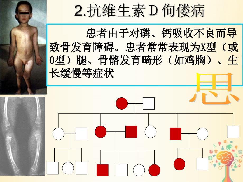 江西省吉安县高中生物第二章基因和染色体的关系2.3伴性遗传课时2课件新人教版必修_第3页