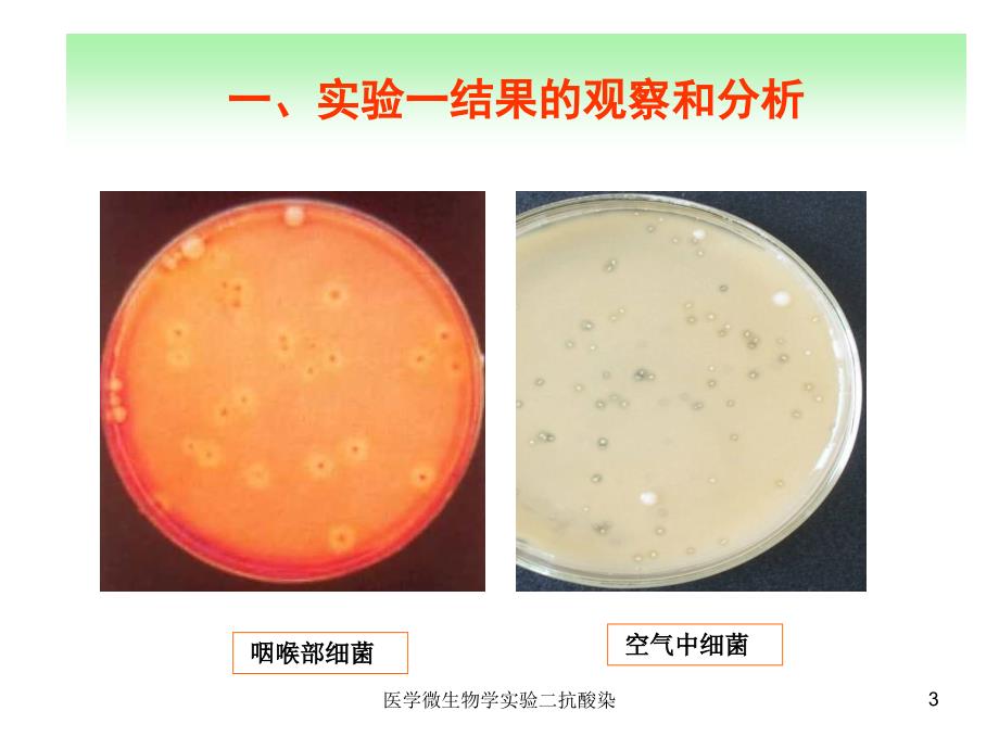 医学微生物学实验二抗酸染课件_第3页