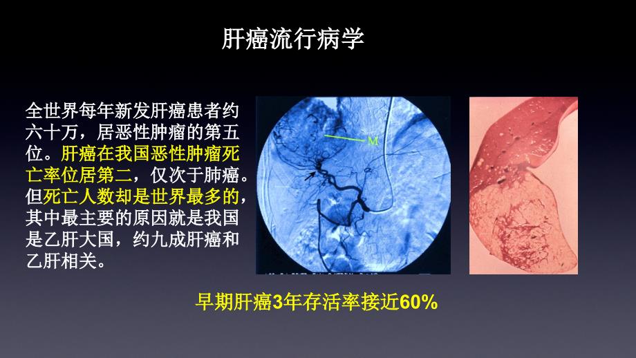 肝脏病灶双期GSI检查分析诊断课件_第2页