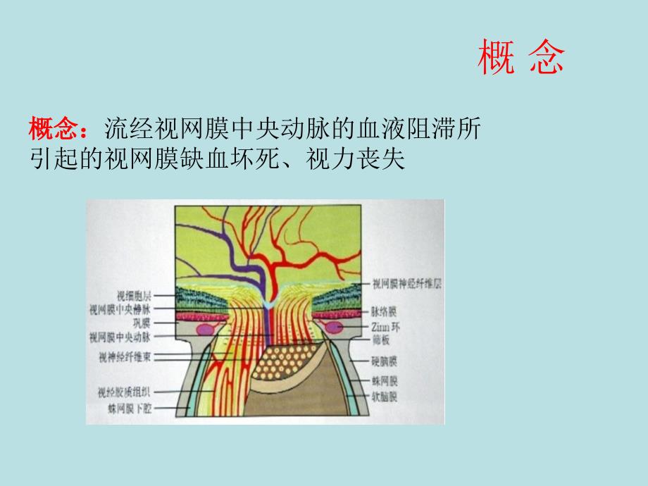 视网膜中央动脉阻塞2_第2页