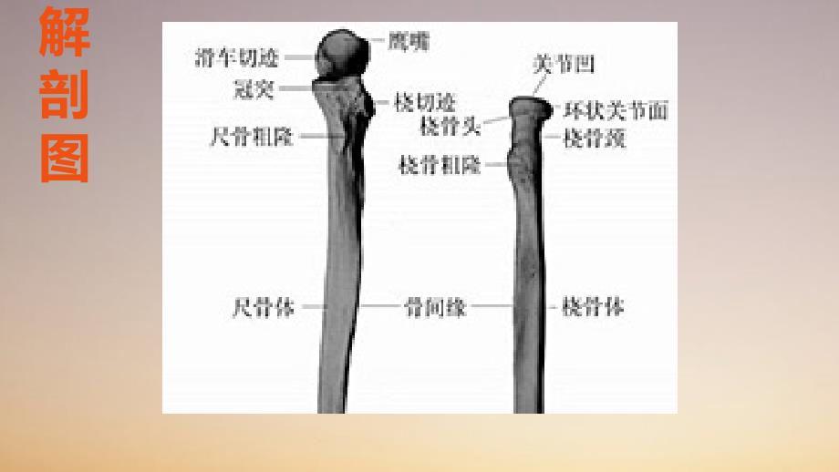 尺桡骨骨折护理_查房_第4页