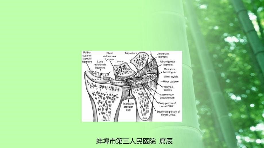 关节镜下治疗三角纤维软骨复合体损伤_第5页