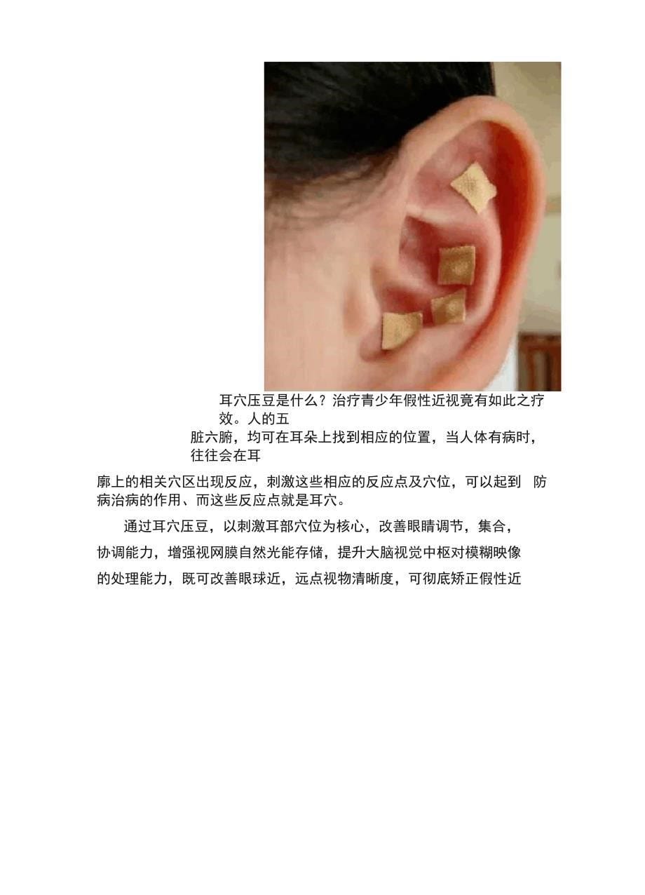 “耳穴疗法”让近视的孩子重新“看清了”世界_第5页
