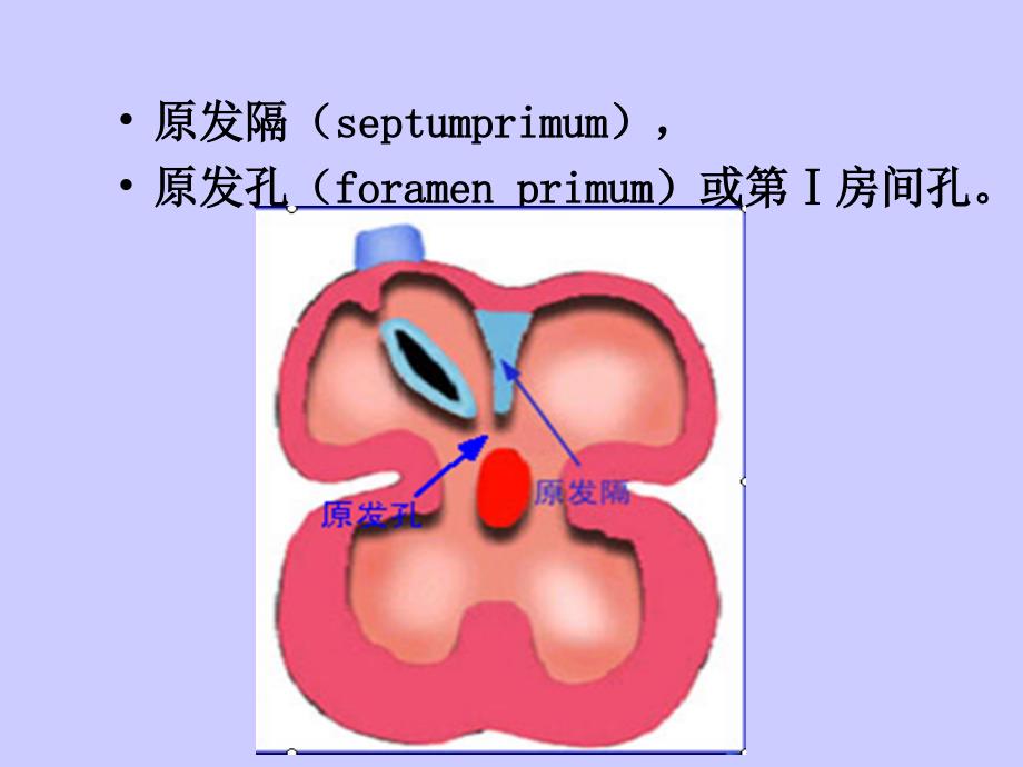 房间隔缺损超声诊断_第4页