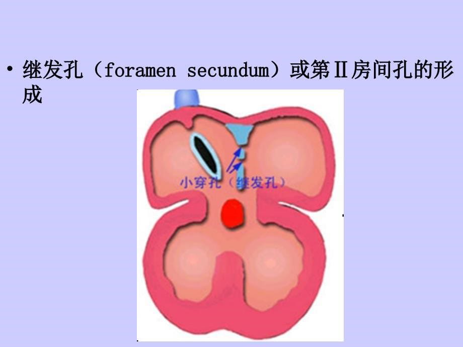 房间隔缺损超声诊断_第5页