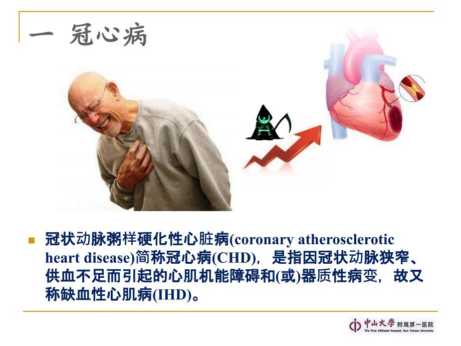 冠心病外科治疗现状课件_第2页