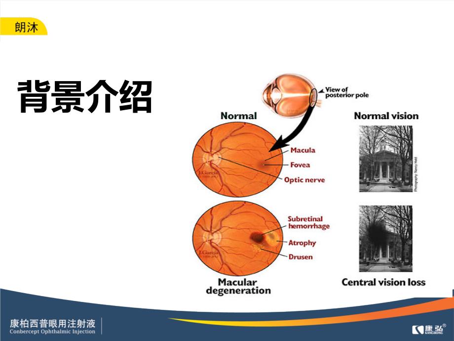 专家谈康柏西普ppt课件_第2页