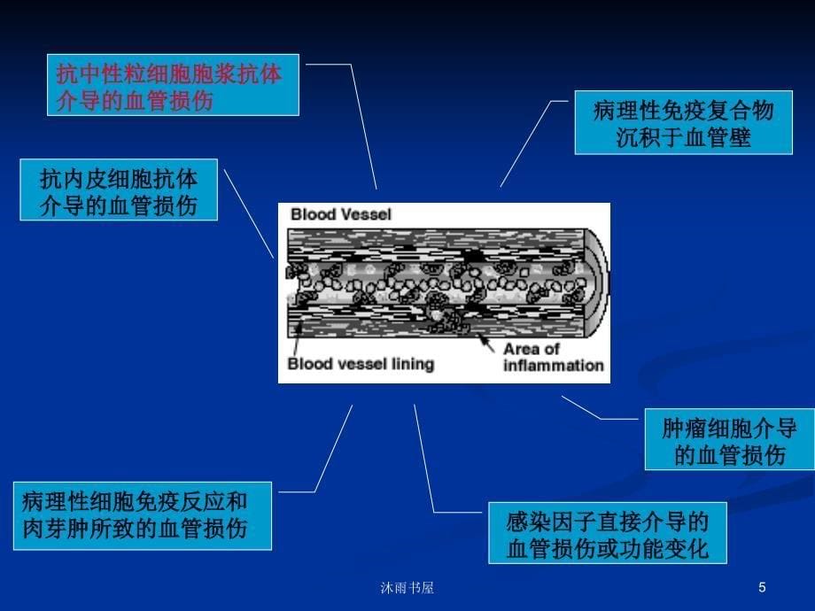 ANCA相关性血管炎[智囊书屋]_第5页