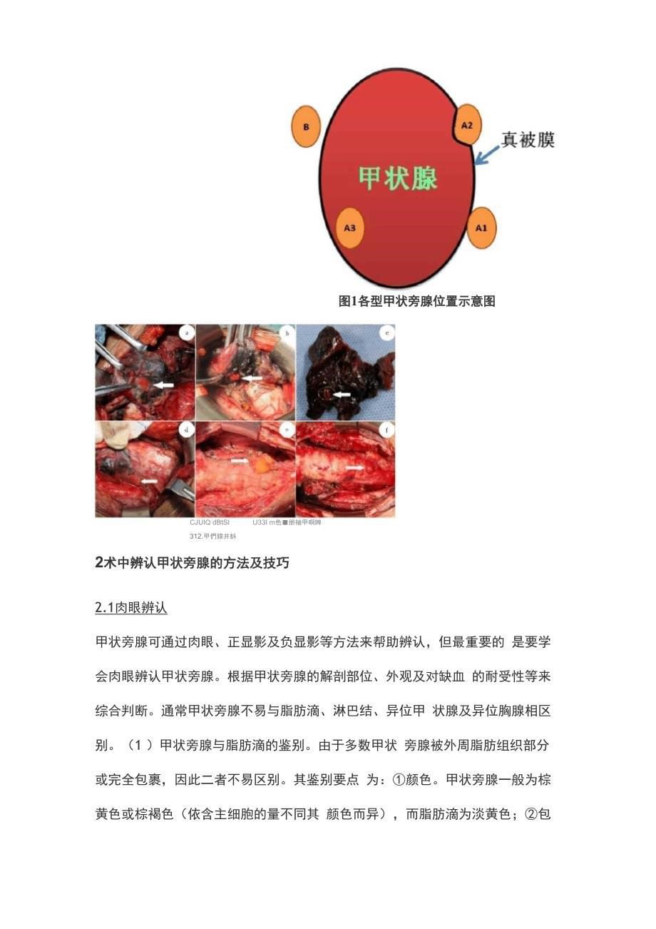 甲状腺手术中甲状旁腺保护专家共识_第5页