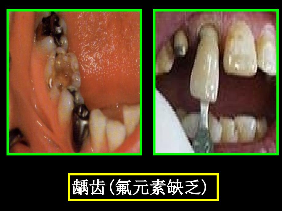 人教版初中化学《化学元素与人体健康》课件2_第3页