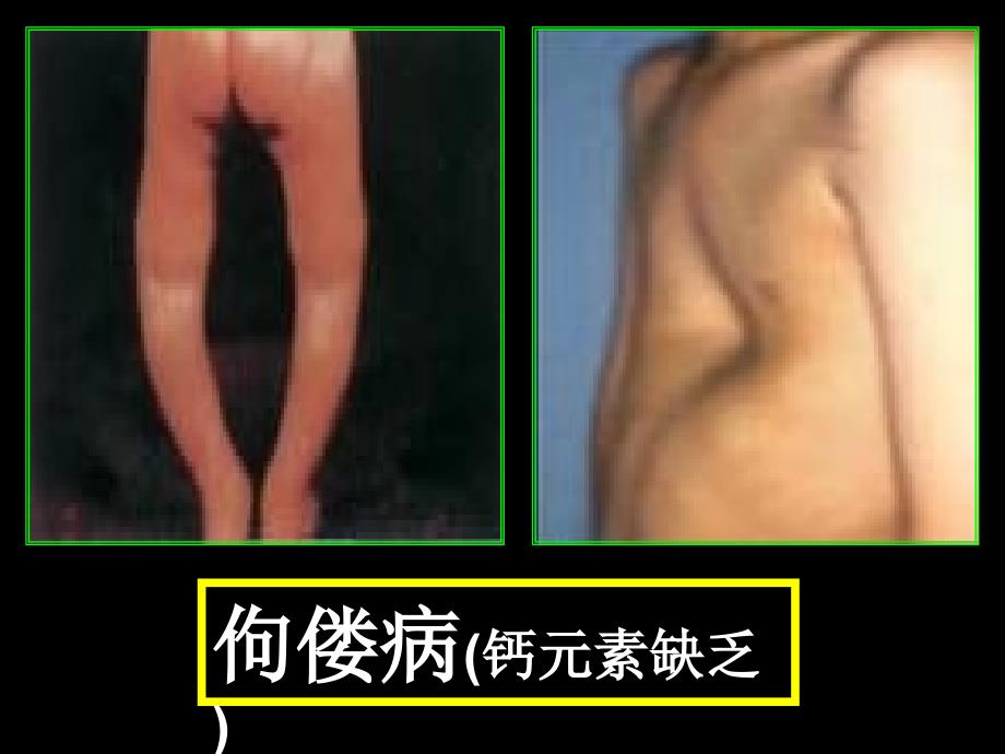 人教版初中化学《化学元素与人体健康》课件2_第4页