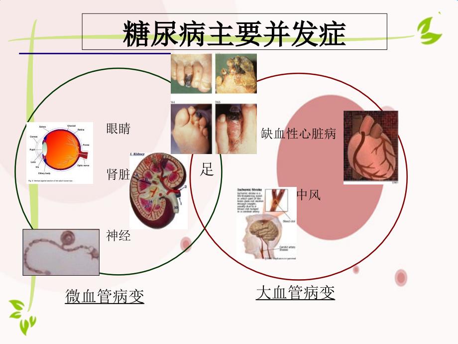 糖尿病高血压中医健康教育讲座_第3页