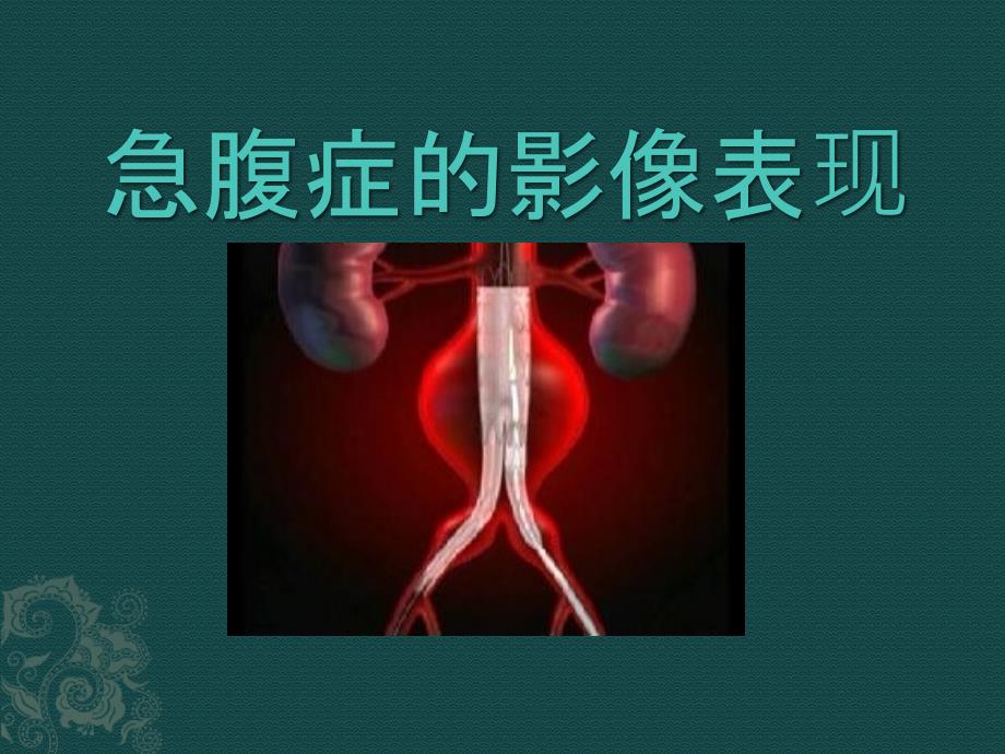 急腹症的影像表现_第1页