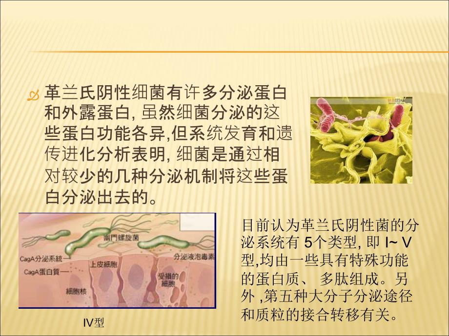 细菌III型分泌系统.ppt_第4页