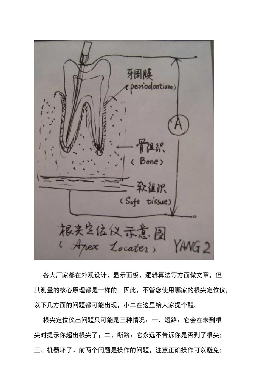 根管测量仪误报原因_第2页