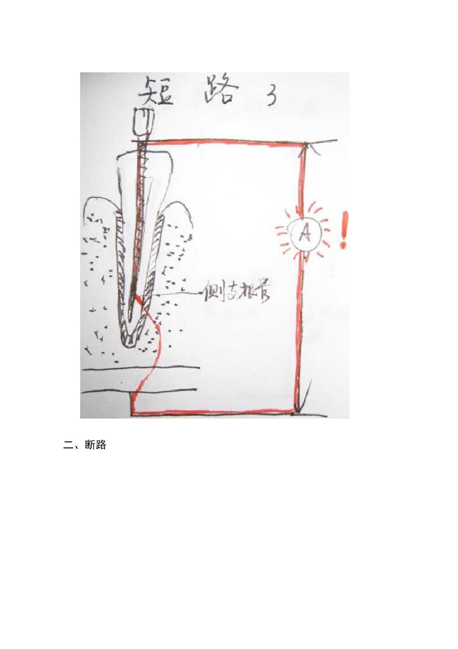 根管测量仪误报原因_第5页