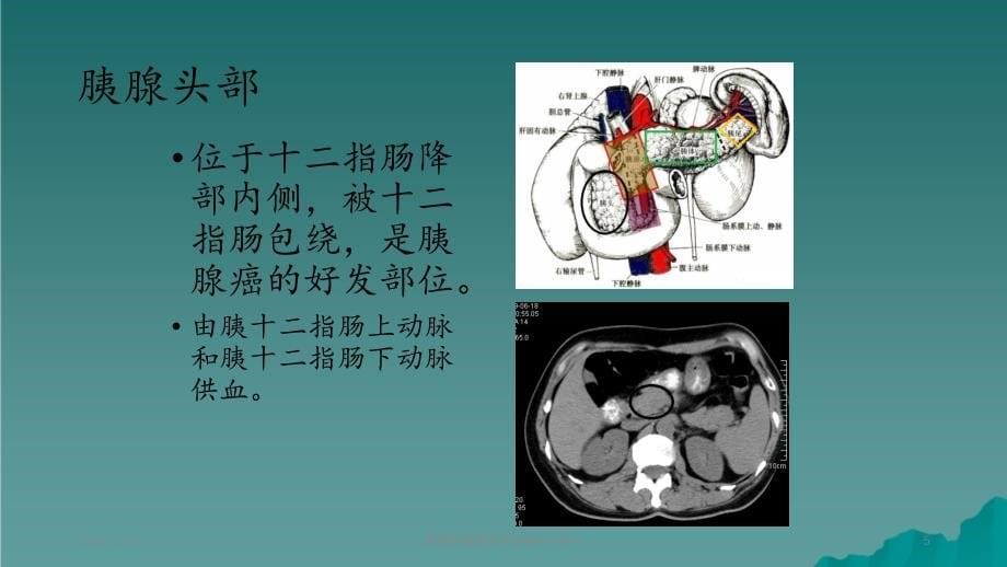 胰腺肿瘤影像学诊断2_第5页