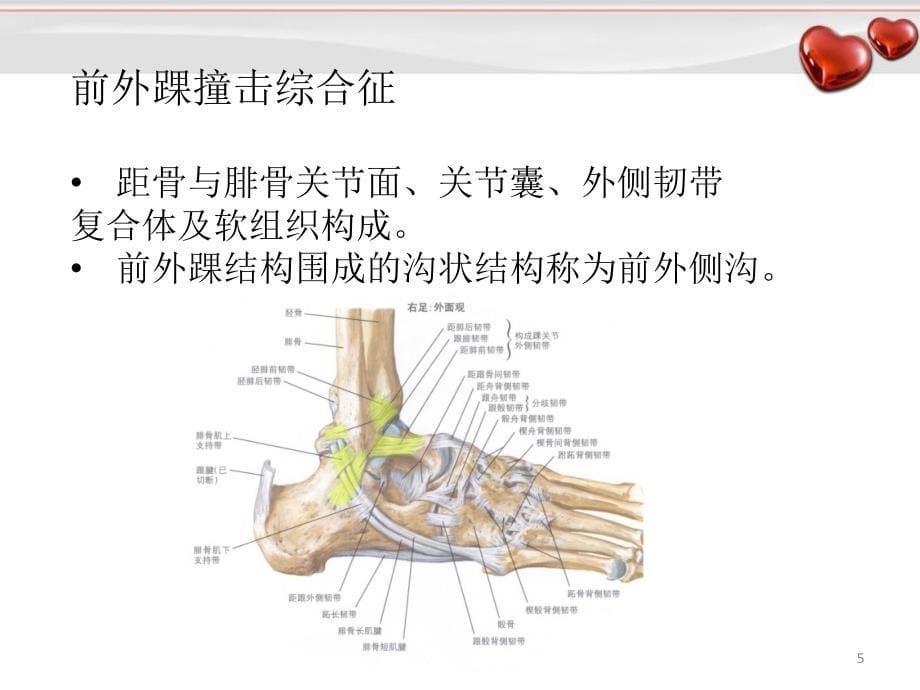 医学PPT课件踝关节撞击综合征_第5页