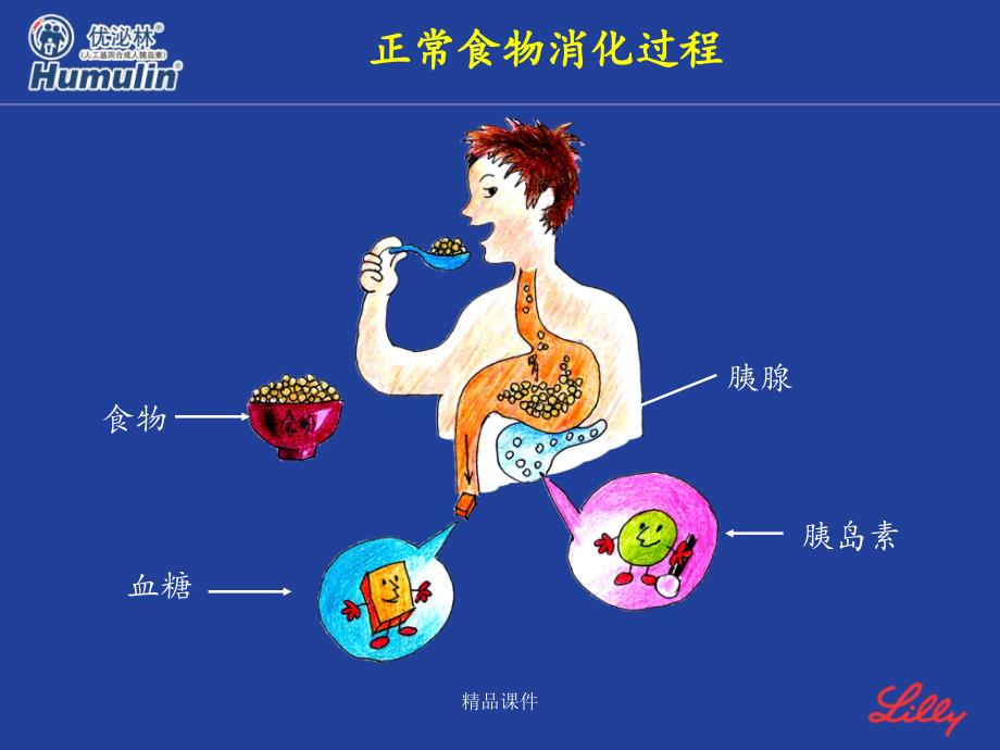 低血糖的原因、症状及处理课件_第2页